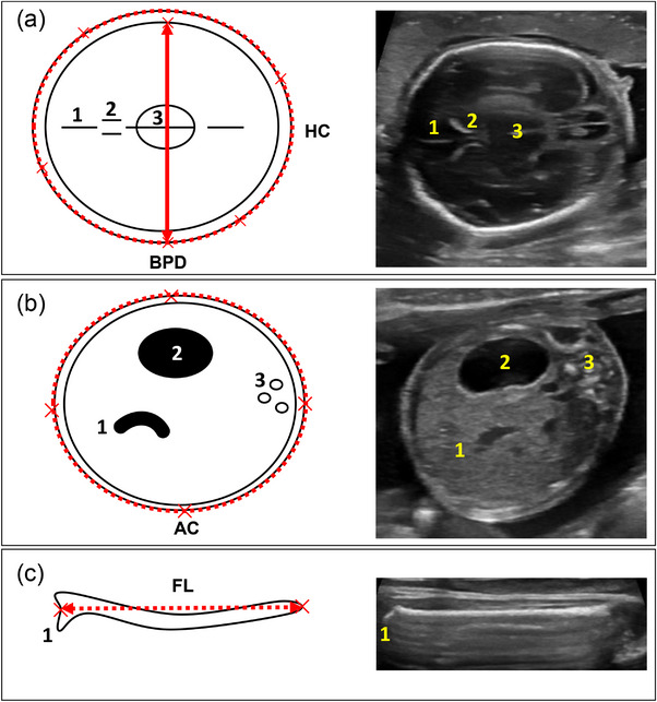 FIGURE 1