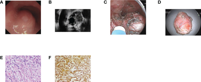 Figure 1