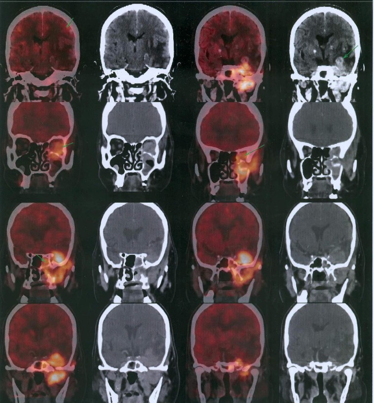 Figure 3