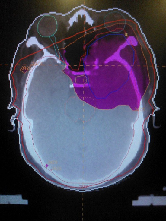 Figure 7