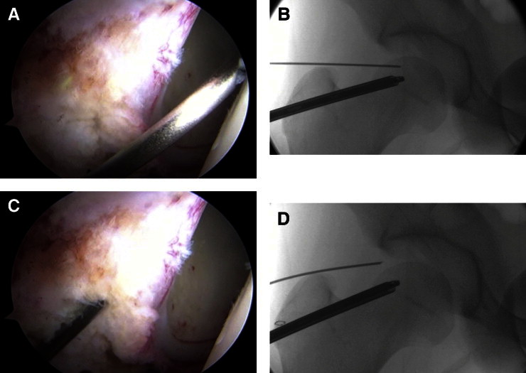 Figure 6