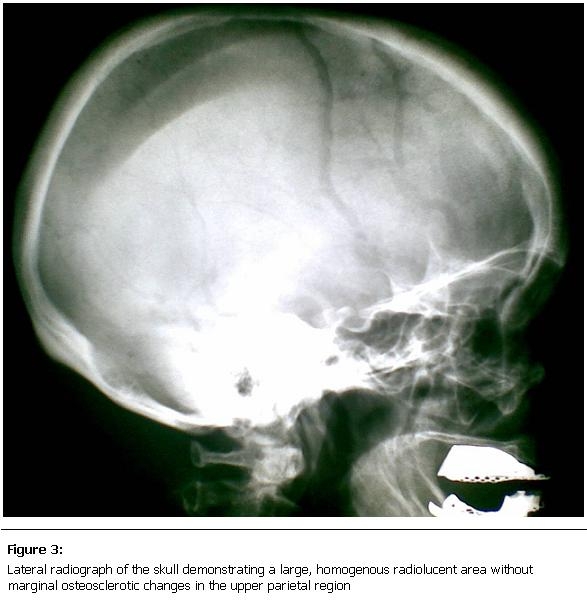 Figure 3: