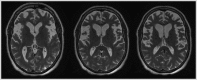 Figure 5-1