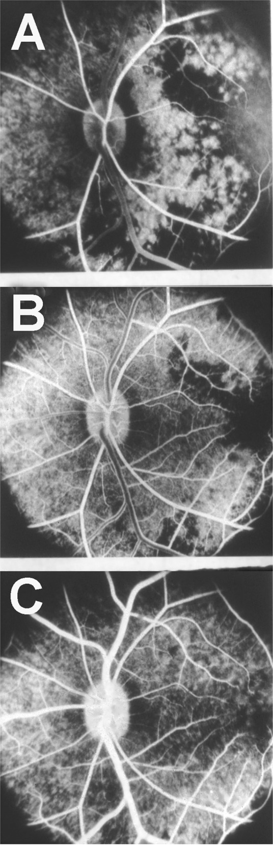 Fig. 17