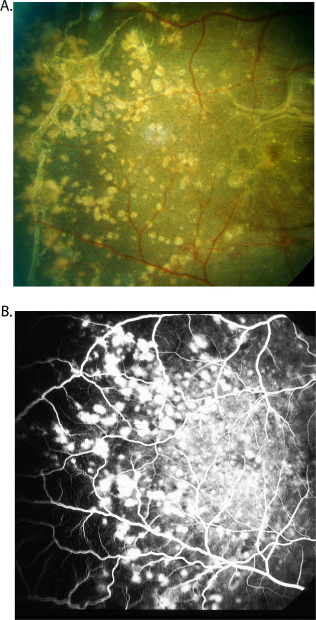 Fig. 12