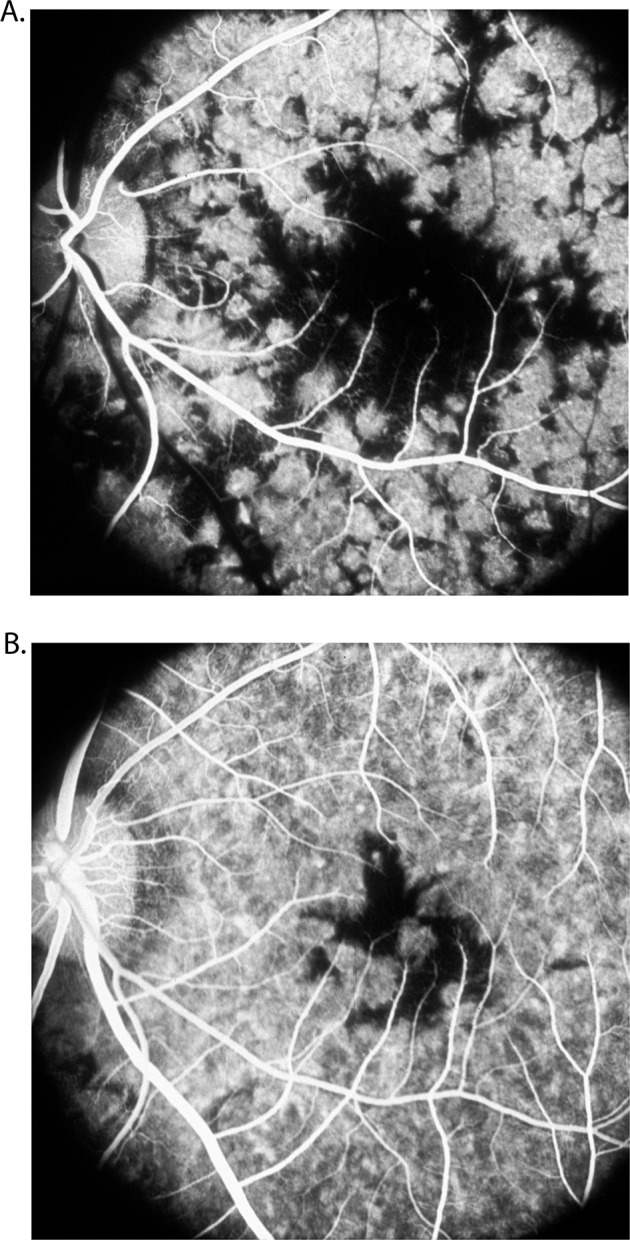 Fig. 19