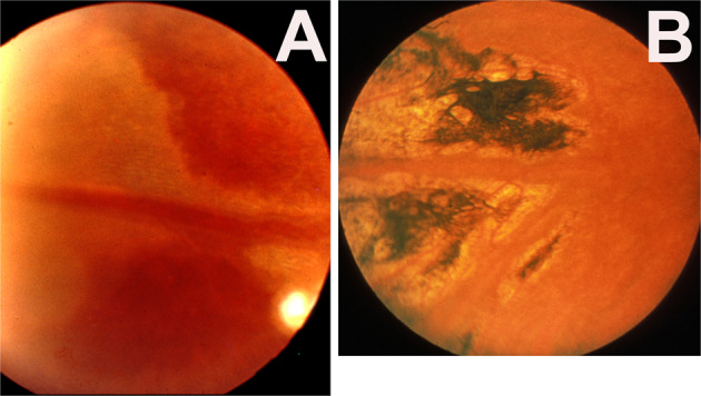 Fig. 14