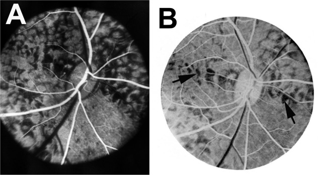 Fig. 25