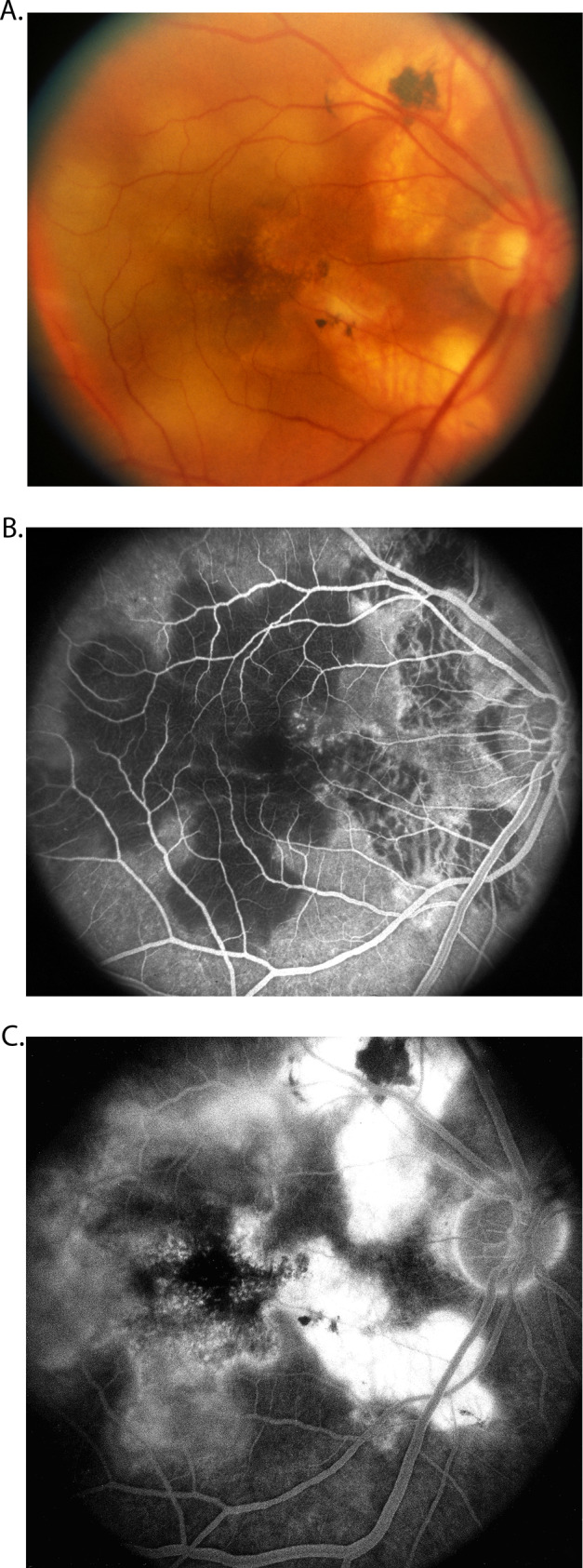 Fig. 13