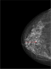 Fig. 4