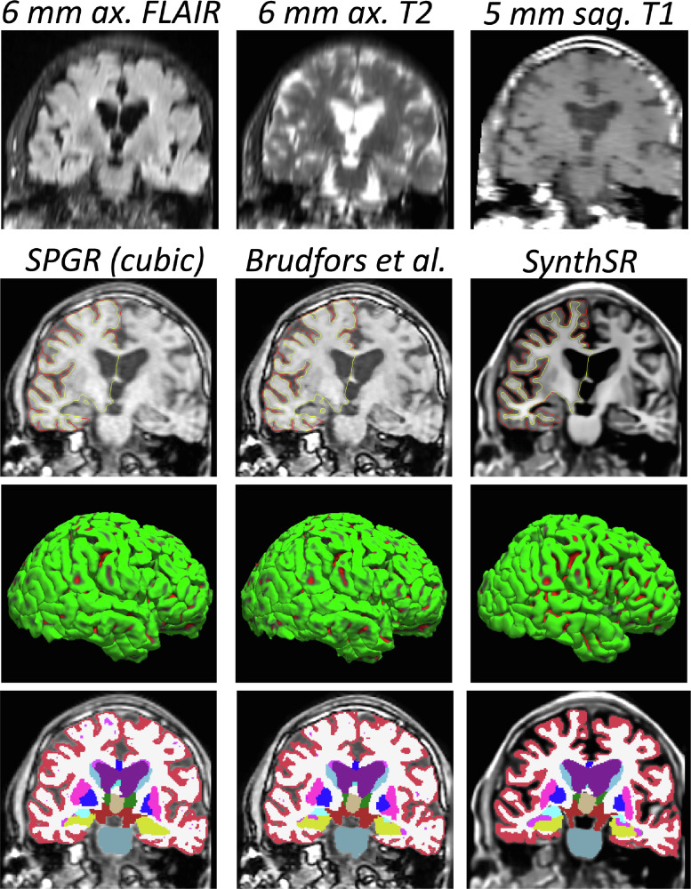 Fig. 11