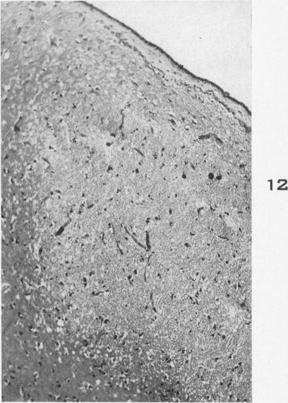 Fig. 12