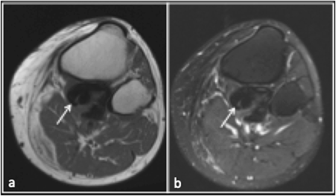 Imaging review of normal anatomy and pathological conditions involving ...