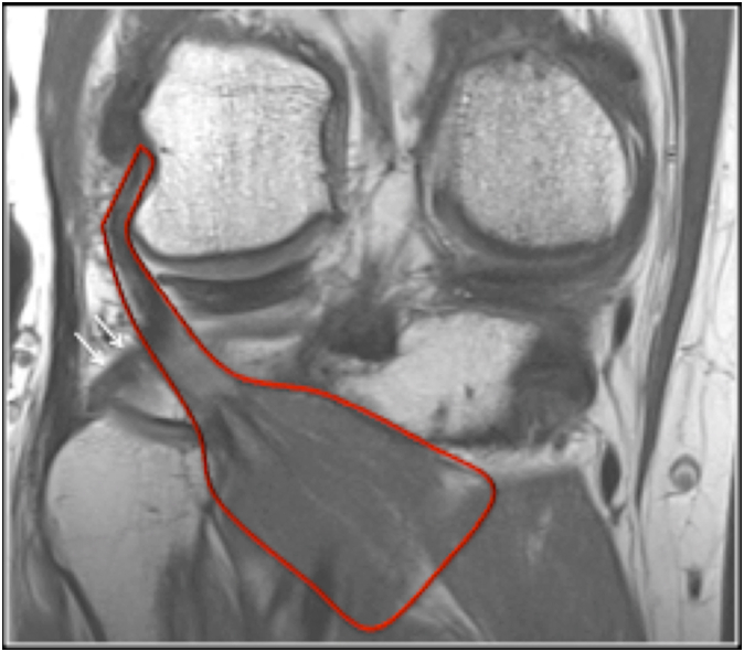 Imaging review of normal anatomy and pathological conditions involving ...