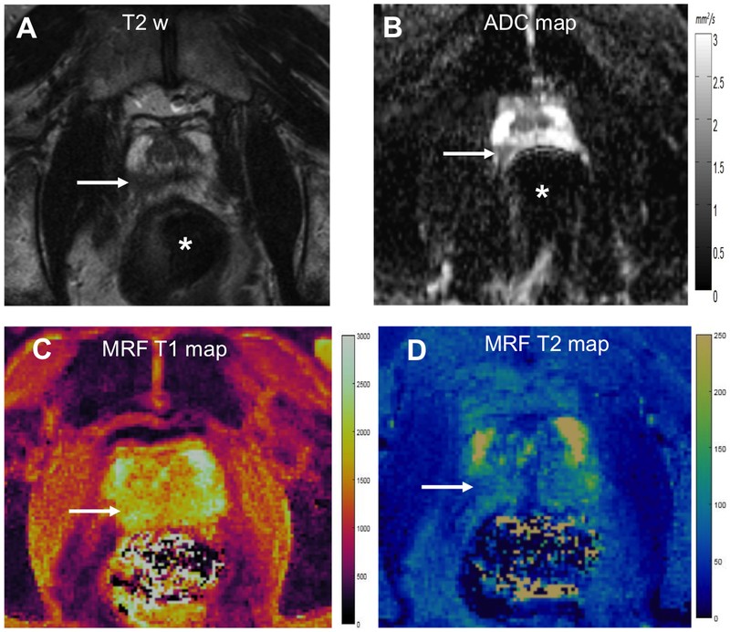 Figure 6: