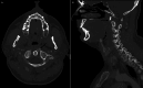 Fig 2: