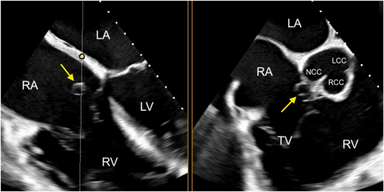 Figure 3