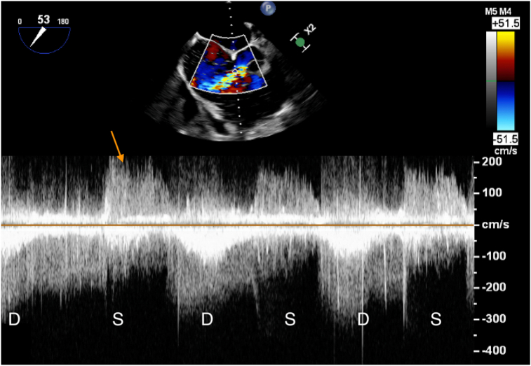 Figure 5