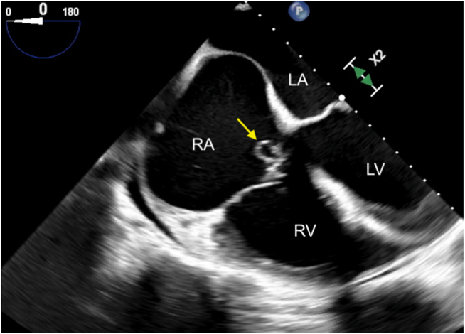 Figure 2