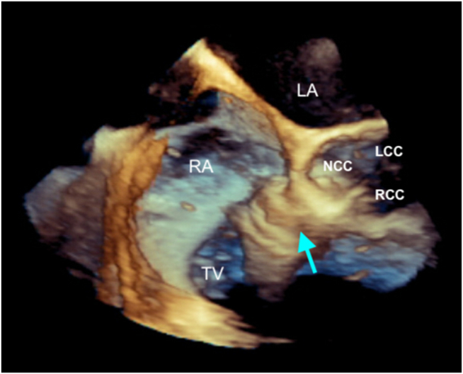 Figure 10