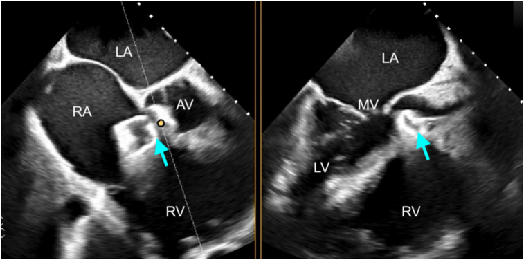 Figure 9