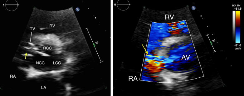 Figure 1