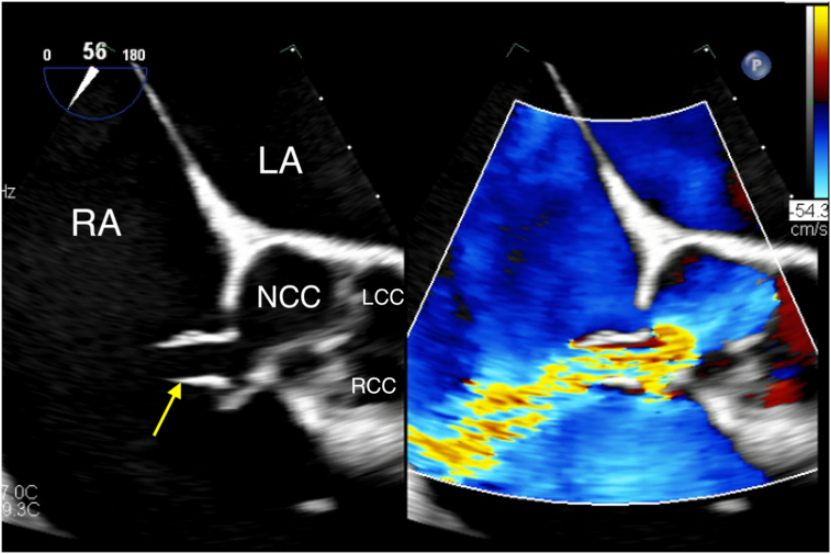 Figure 4