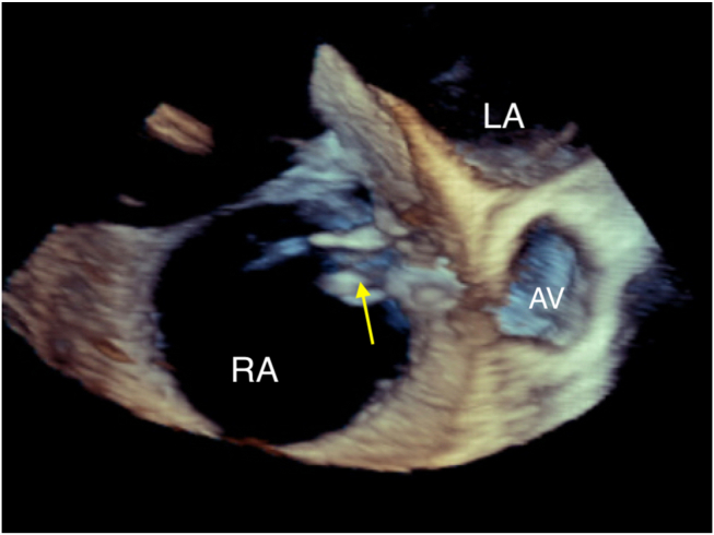 Figure 6