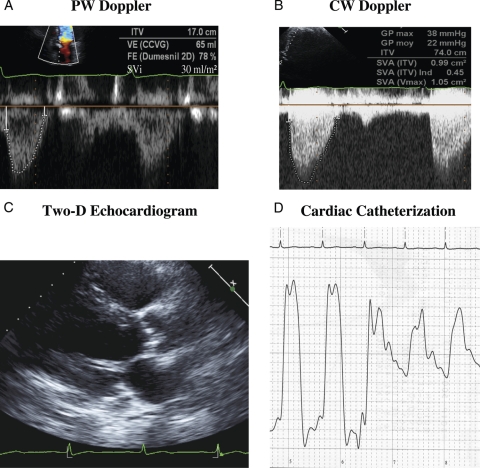 Figure 1