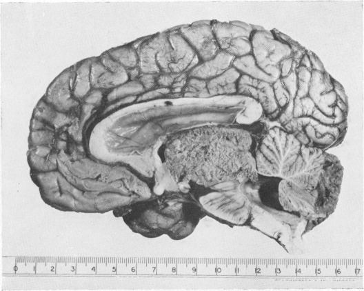 Fig. 15