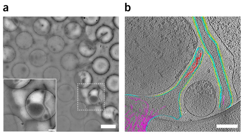 Figure 11
