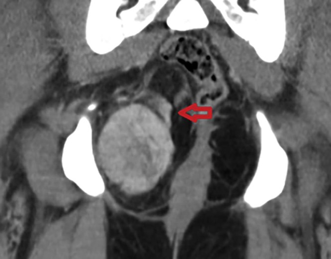 Fig. 15