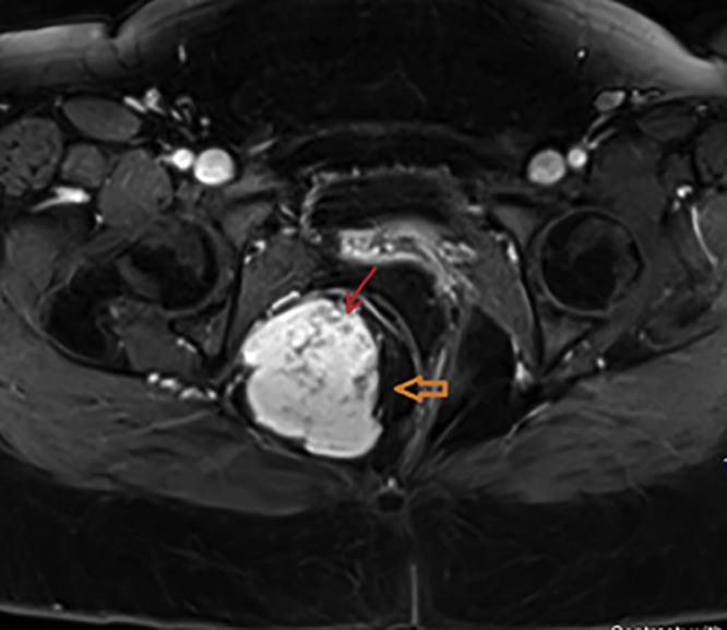 Fig. 2