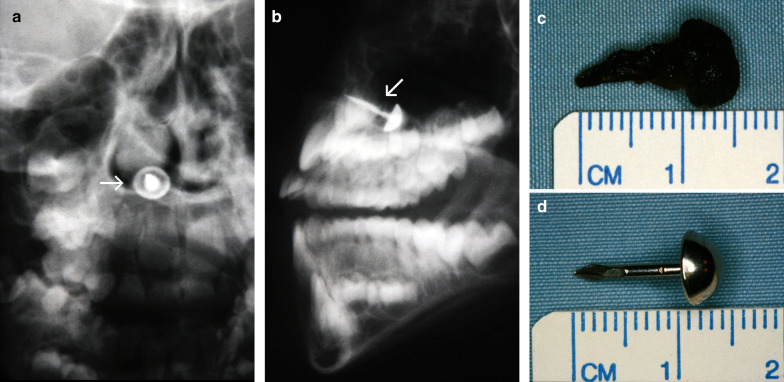 Fig. 5