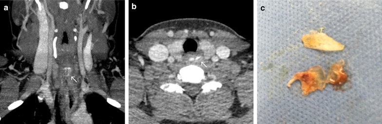 Fig. 16