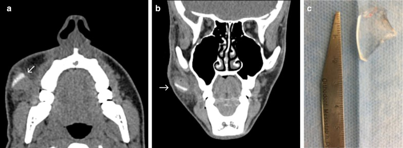 Fig. 11