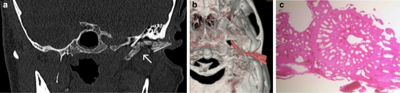 Fig. 15