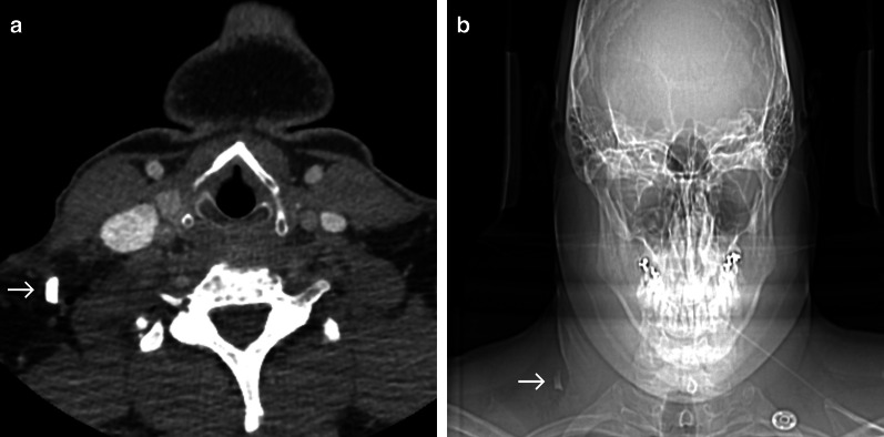 Fig. 10