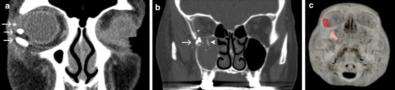 Fig. 12