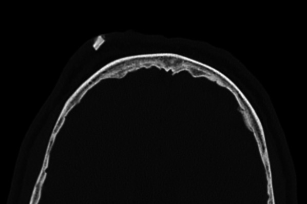 Fig. 14