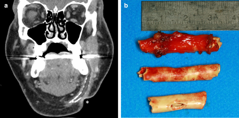 Fig. 13