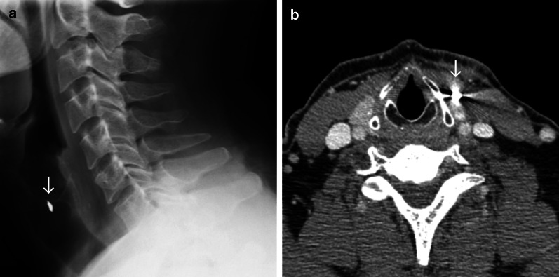 Fig. 7