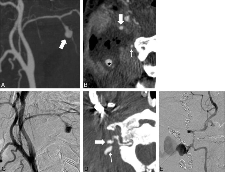 Fig 2.