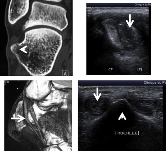 Figure 3