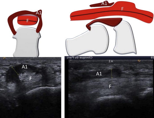 Figure 6