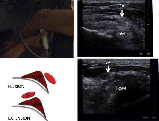 Figure 11