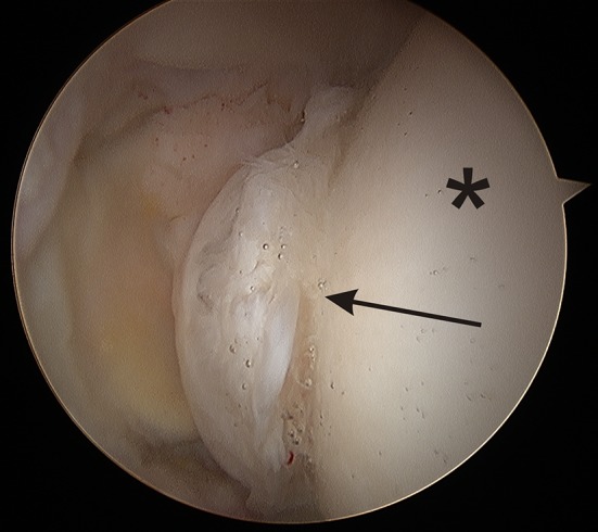 Fig. 2