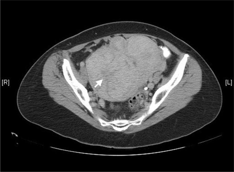 Fig. 1