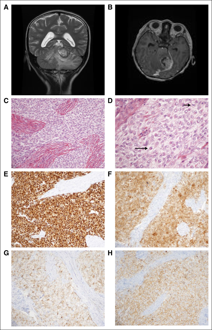 Fig 1.