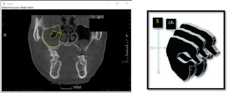 Fig. 1